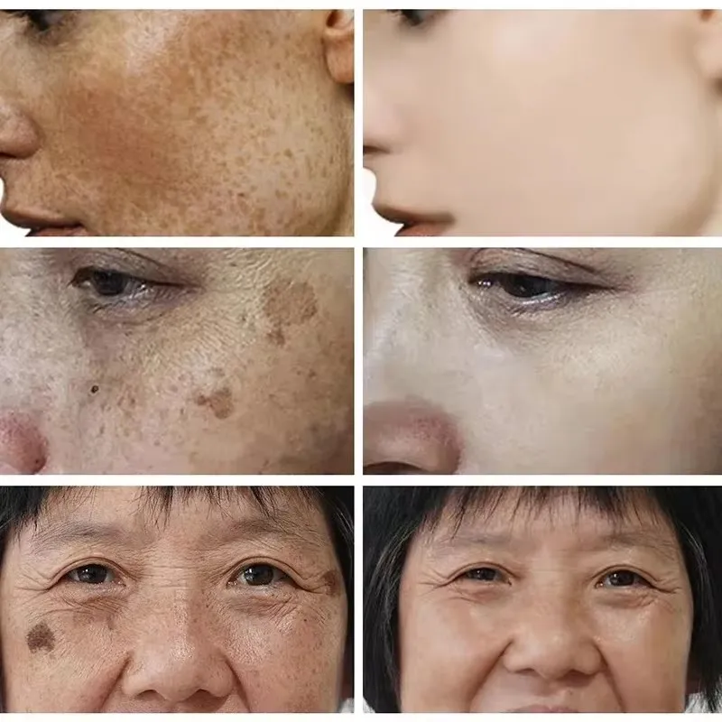Crème blanchissante pour les t - Skincare Glad2Glow avis et prix
