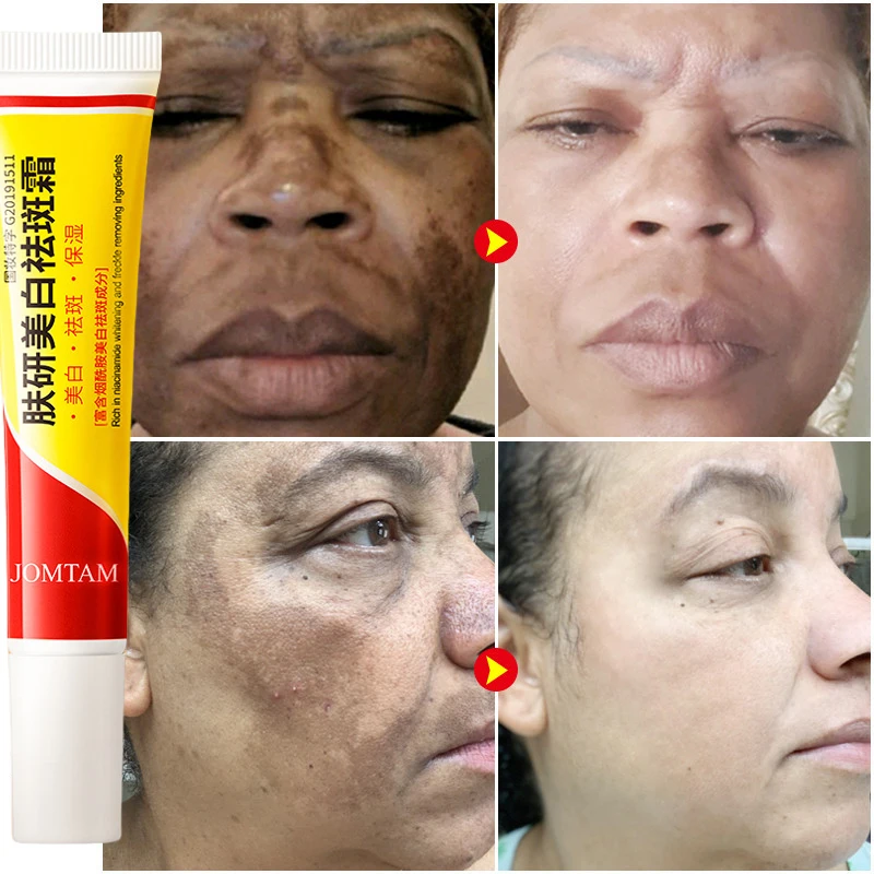 Crème blanchissante pour les t - Skincare Glad2Glow avis et prix